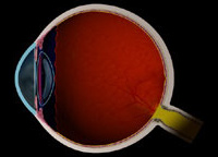 Nearsightedness