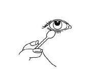 Blepharitis