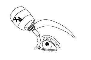Blepharitis