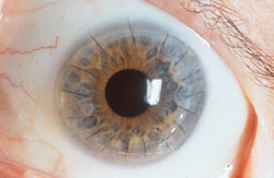 eye