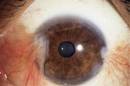 eye