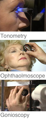 Narrow-Angle Glaucoma