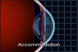 eye
