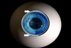 eye