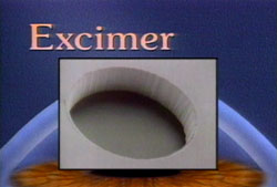 Excimer Laser Technology